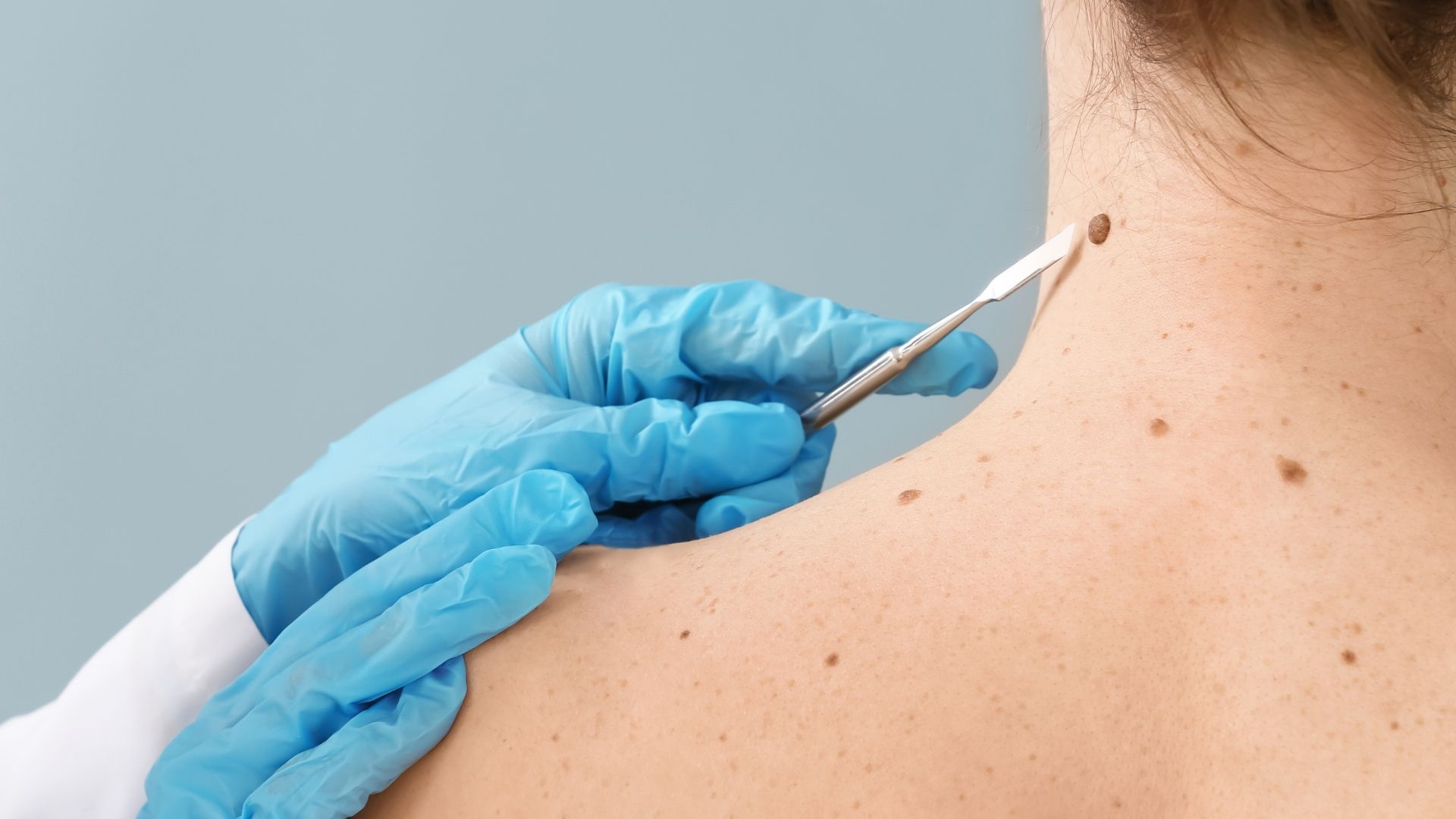 Co to jest chirurgia dermatologiczna i jakie usługi wchodzą w jej skład?