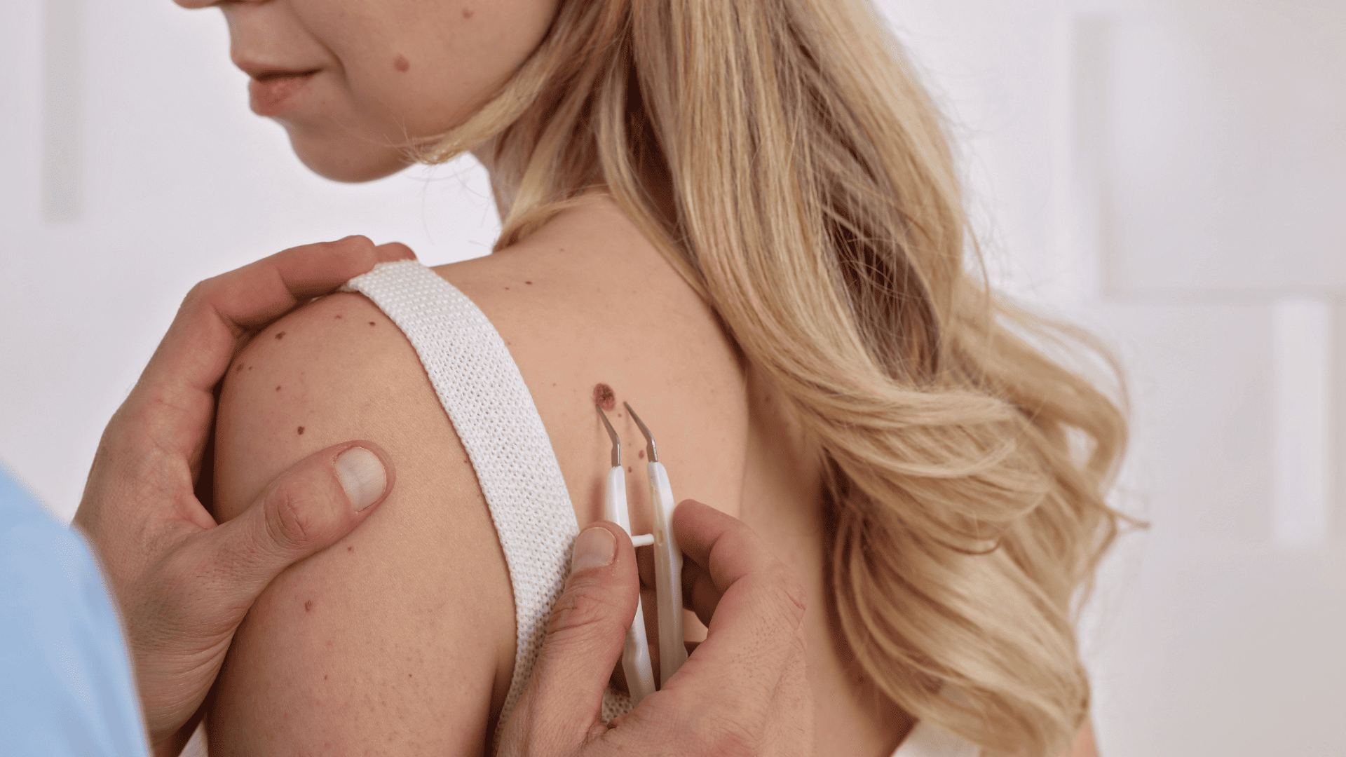 Oglądanie zmiany skórnej przez dermatologa