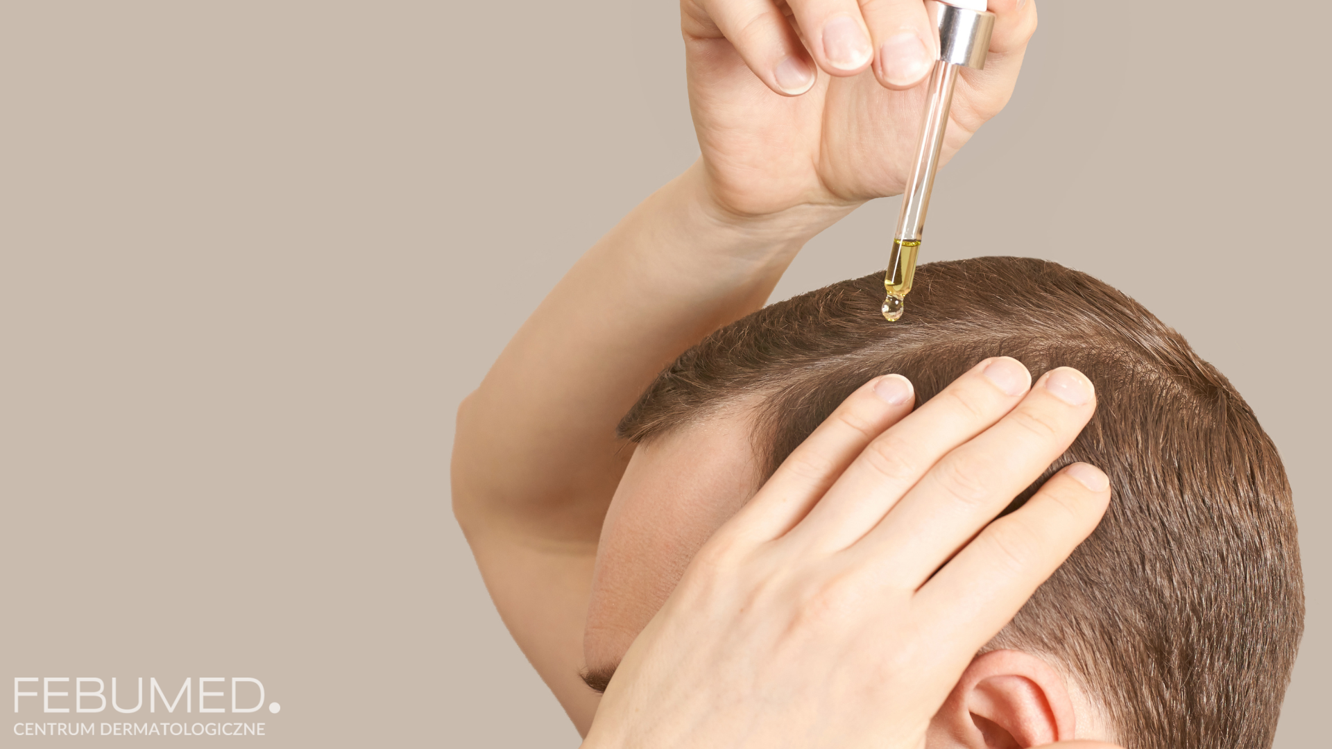pacjent zakrapla preparat na owłosioną skórę głowy w leczeniu wypadania włosów