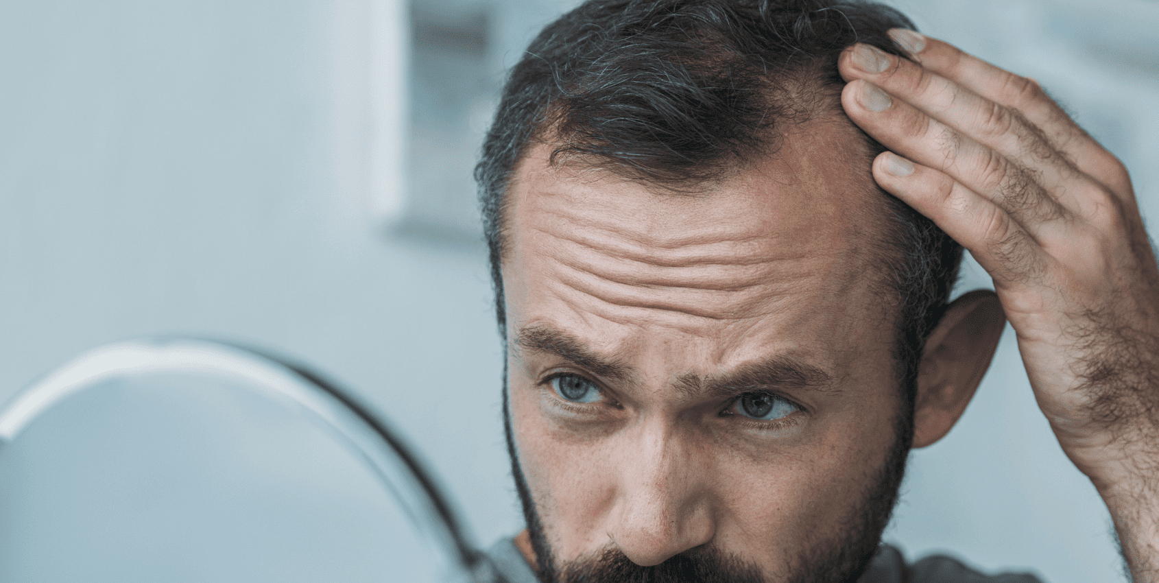 Mężczyzna patrzący w lusterko i zmartwiony swoimi zakolami na głowie i przerzedzeniem włosów