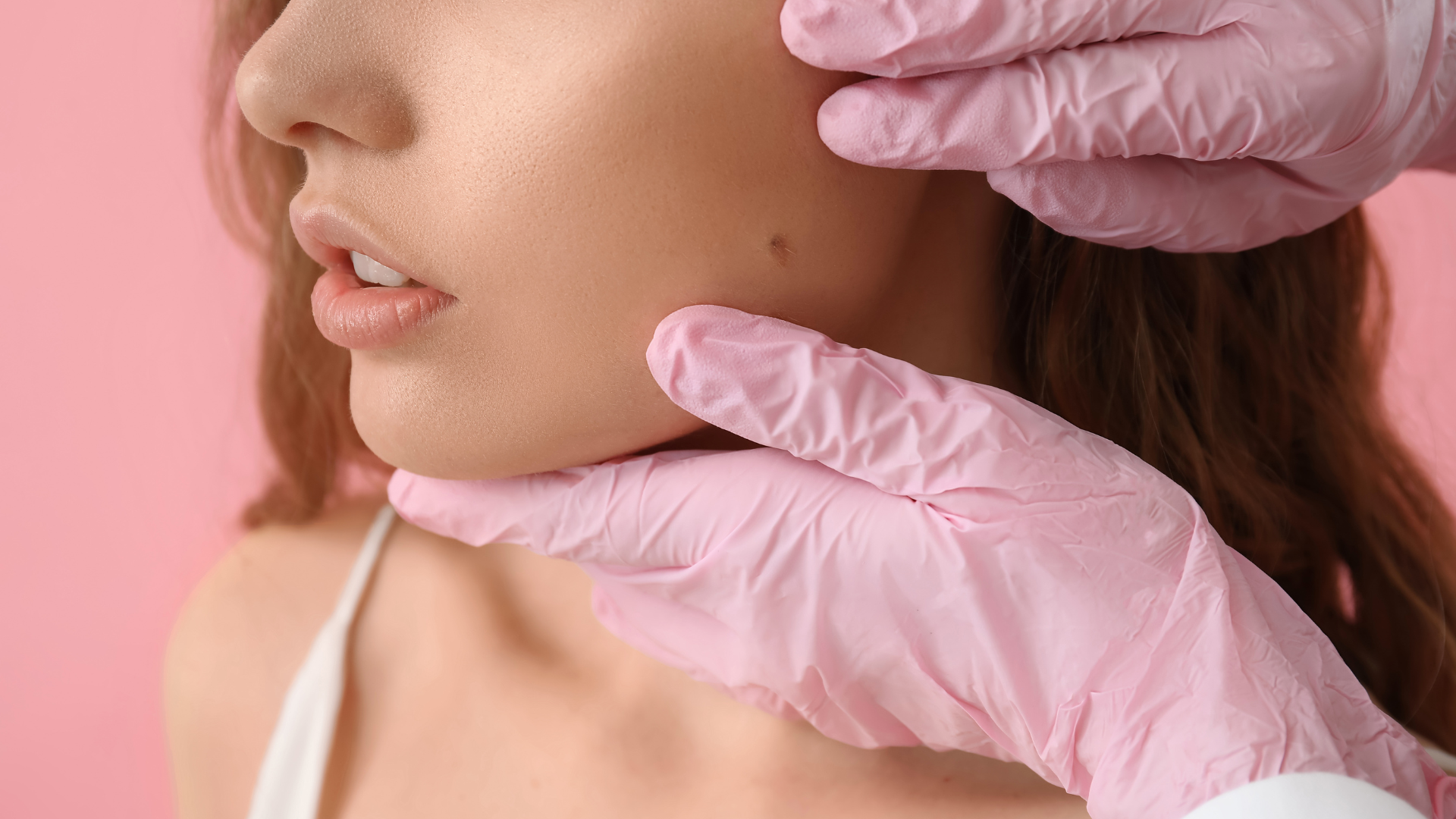 Kobieta ze zmianą do usunięcia na policzku. Dłonie w różowych rękawiczkach dotykające twarzy.