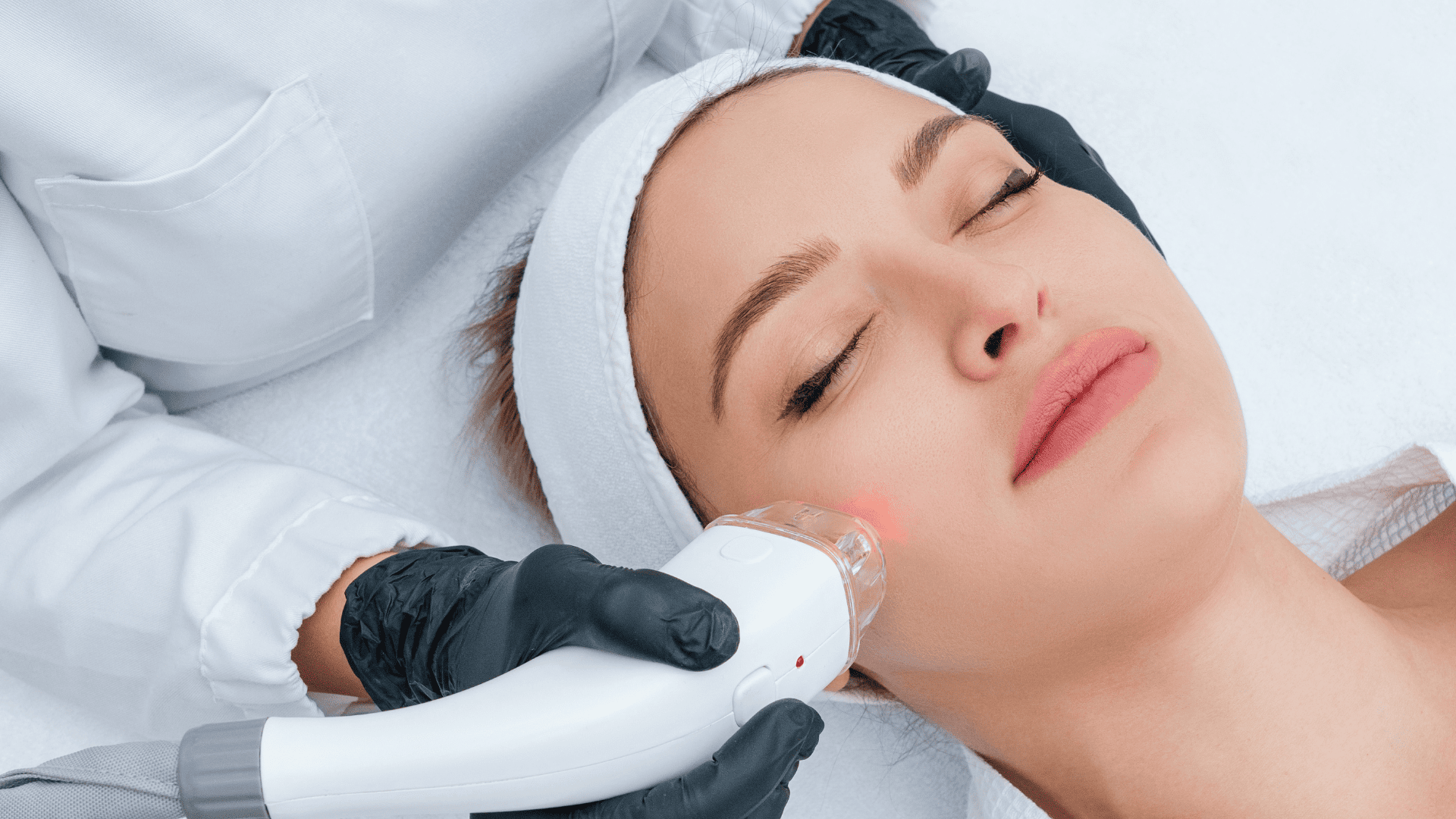 Twarz młodej kobiety , leżącej na plecach z ciemnymi włosami, zakmnietymi oczami i gładką skórą. Za kobietą siedzi lekarz, którego widać tylko fartuch i ręce w rękawiczkach medycznych, który wykonuje zabieg laserem frakcyjnym CO2