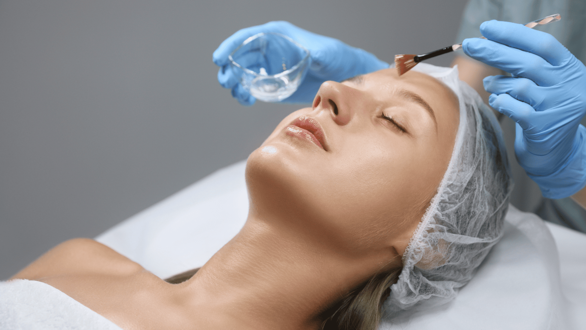 Młoda kobieta leżąca na plecach w czepku siatkowym, podczas gdy lekarz, której widoczne są tylko ręce w rękawiczkach medycznych nakłada jej na twarz peeling wodorowy za pomocą pędzelka, w drugiej ręce trzyma miseczkę z preparatem.