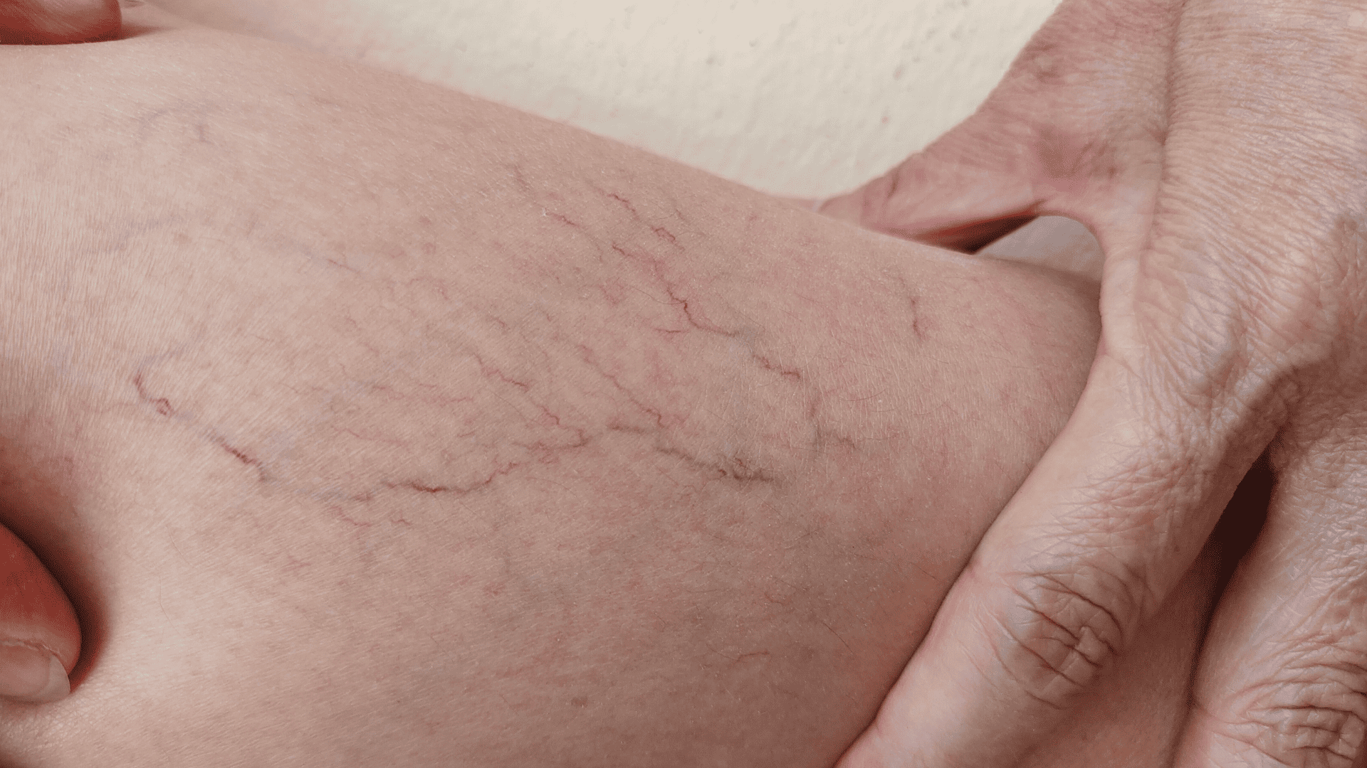 Zbliżenie na otwarte naczynka, układające się w potocznie nazywanego ,,pajączka"