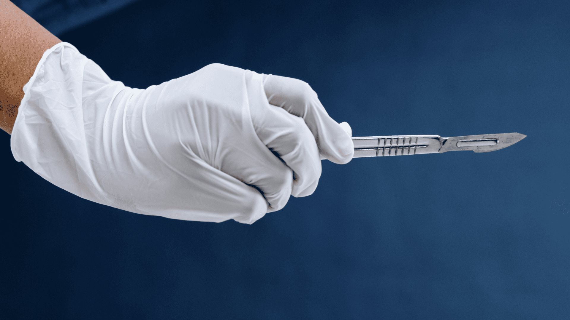 Dłoń w białej rękawiczce trzymająca skalpel.