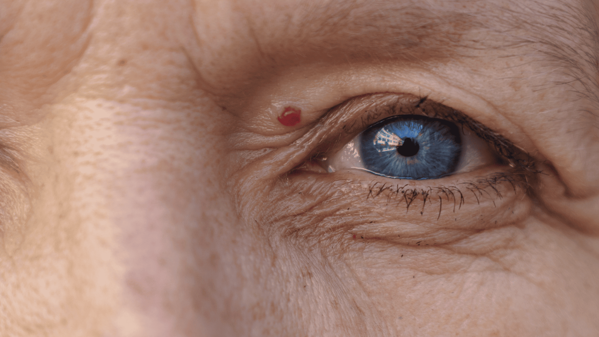 Zbliżenie na twarz mężczyzny, jest widoczne tylko jego lewe oko, koloru niebieskiego i widoczny nad nim naczyniak