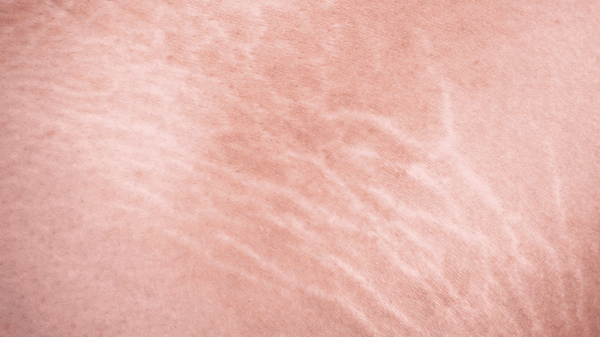 Zbliżenie na rozstępy na skórze