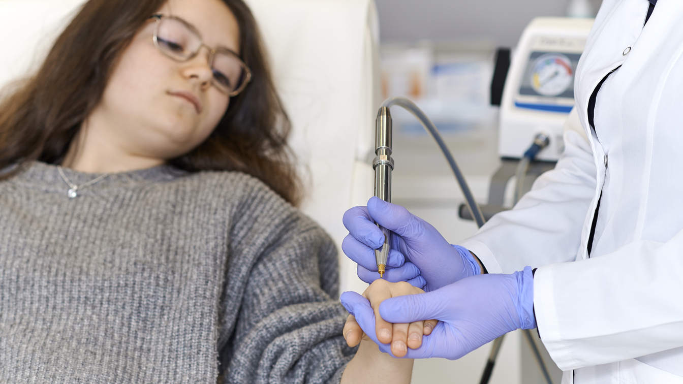 Usuwanie kurzajek metodą kriochirurgii u dziecka