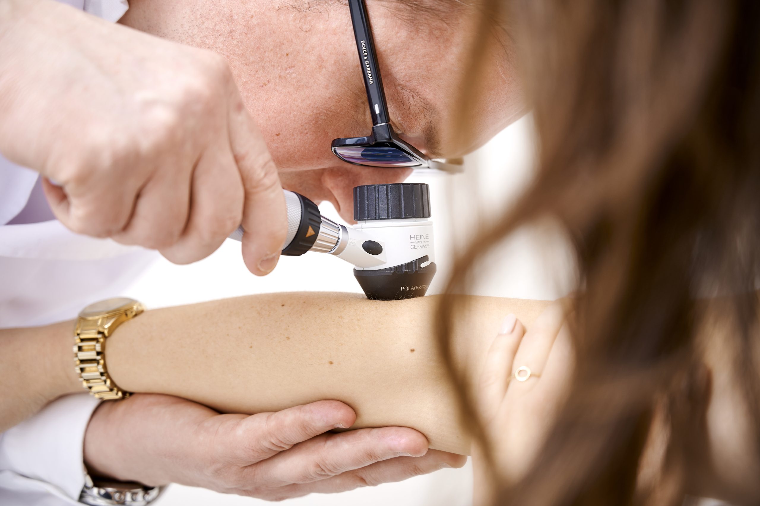 dr Marek Laskowski bada zmiany dermatoskopem u pacjentki