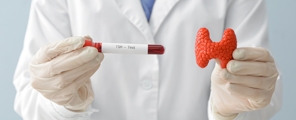 Lekarz w rękawiczkach trzyma probówkę z krwią do badania TSH oraz model tarczycy - diagnostyka Hashimoto