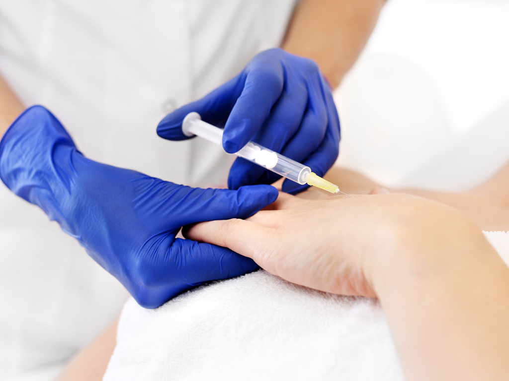 lekarz w niebieskich rękawiczkach wykonuje mezoterapię igłową dłoni