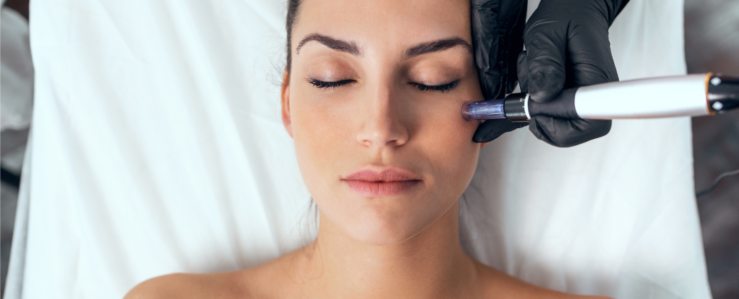 Kosmetolog wykonuje zabieg mikronakłuwania frakcyjnego Dermapen na twarzy pacjentki
