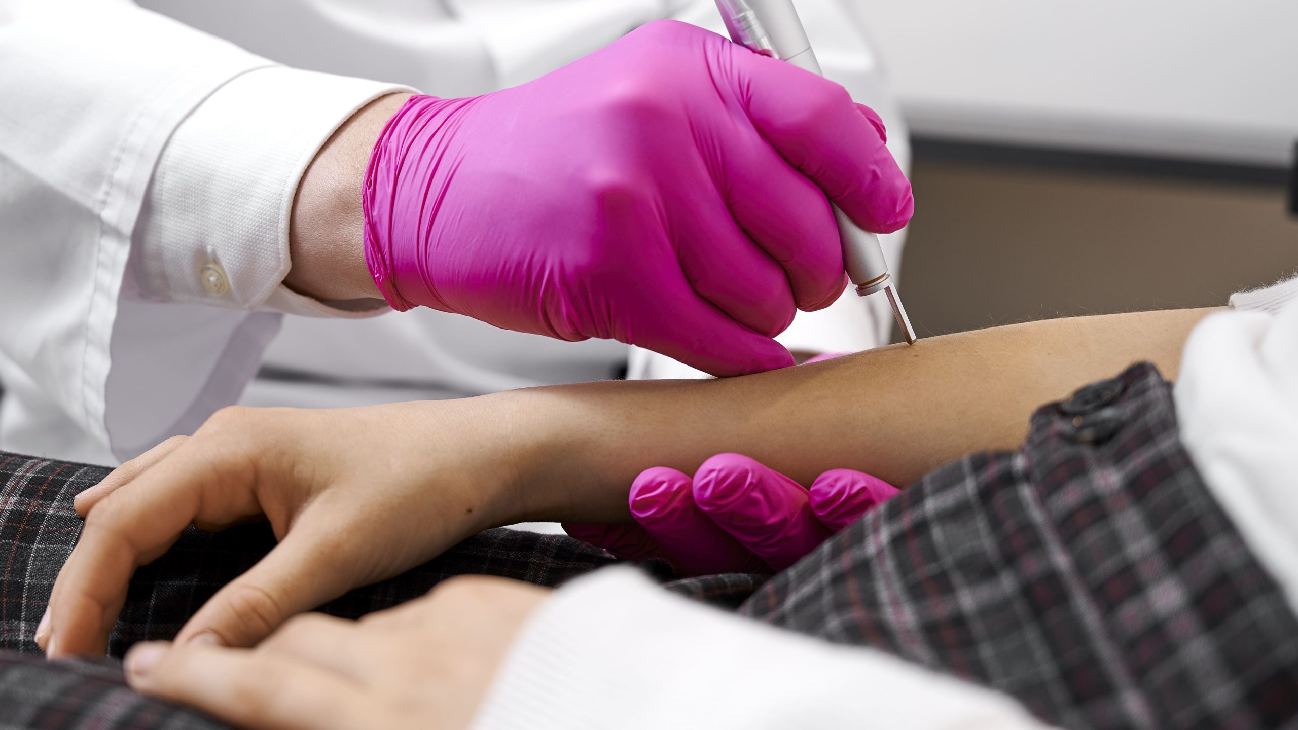 Co warto wiedzieć o laserowym usuwaniu zmian skórnych?