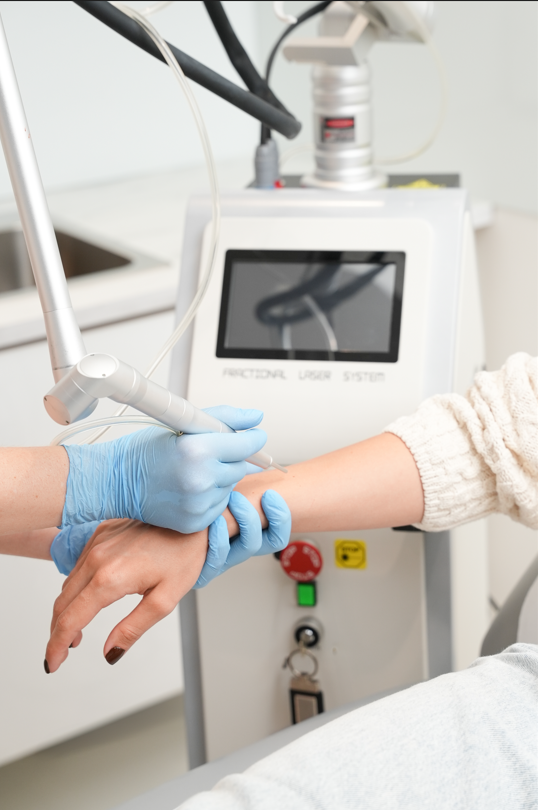 Widoczne rece specjalisty w niebieskich rekawiczkach, lekarz wykonuje zabieg laserowy na rece młodej kobiety z pomalowanymi na brązowo paznokciami