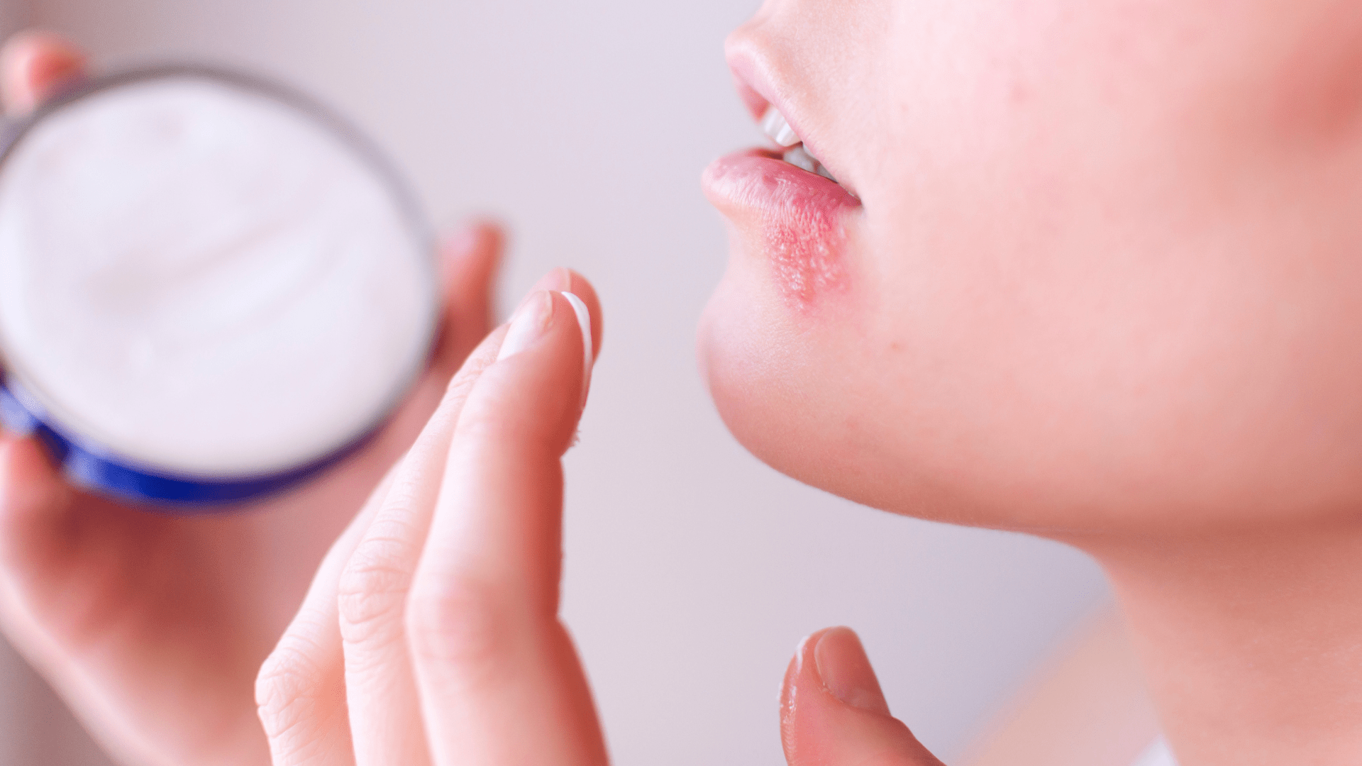 Opryszczka - przyczyny, objawy, leczenie i jak zapobiegać nawrotom?